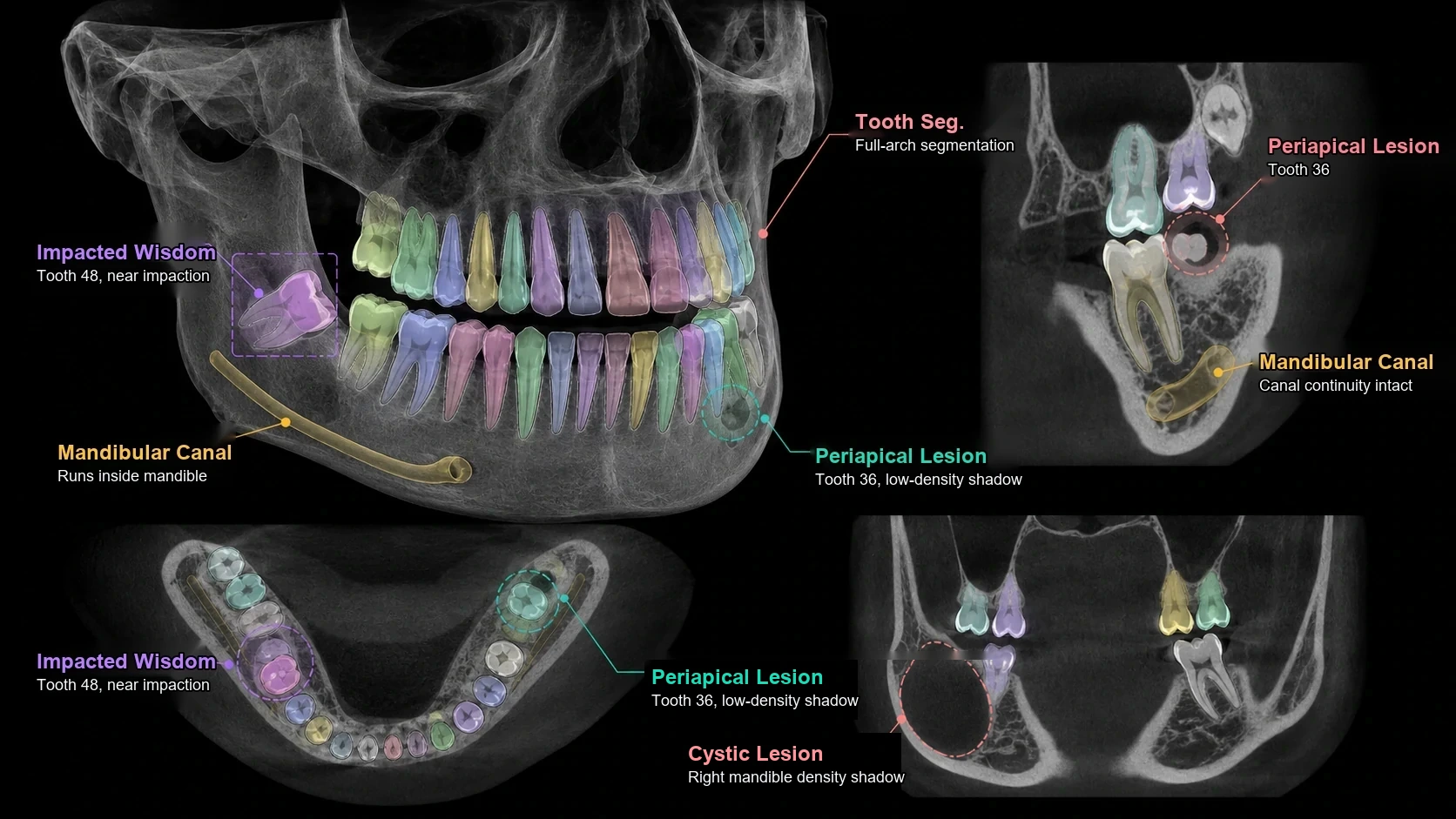 CBCT AI detection and segmentation
