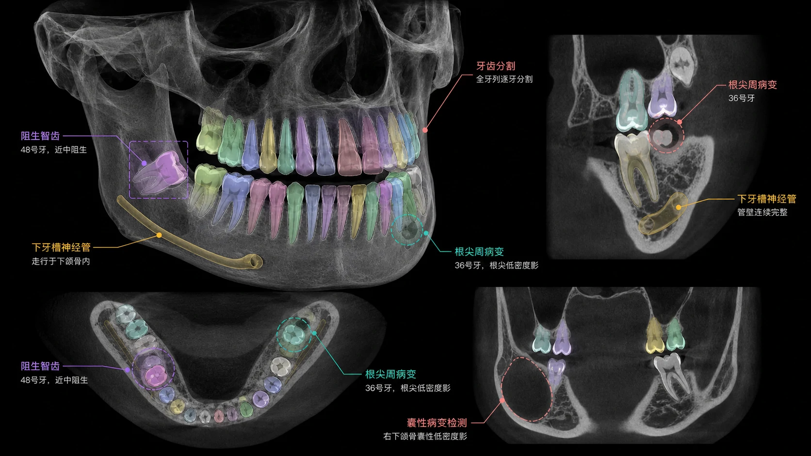 CBCT AI 调用示意图