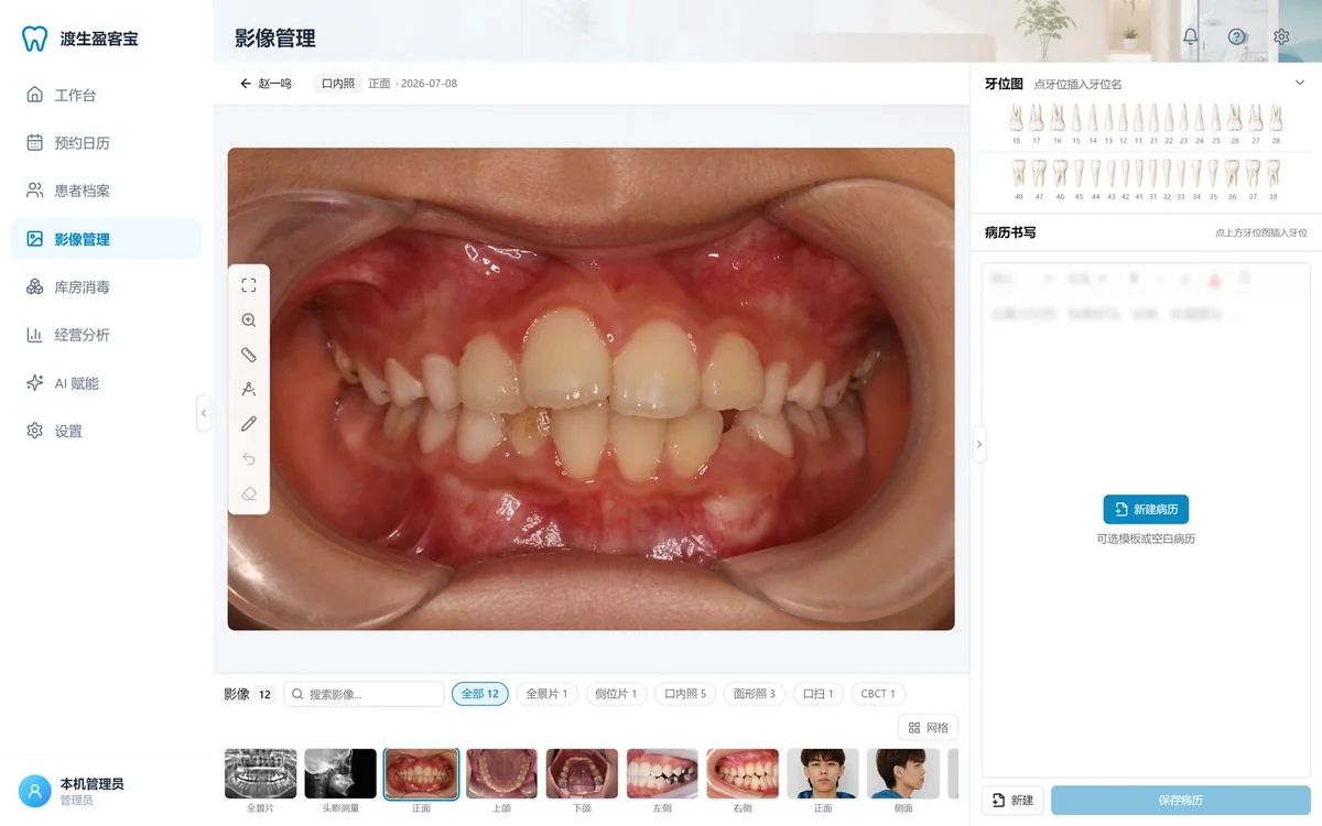 Viewer: intraoral photo
