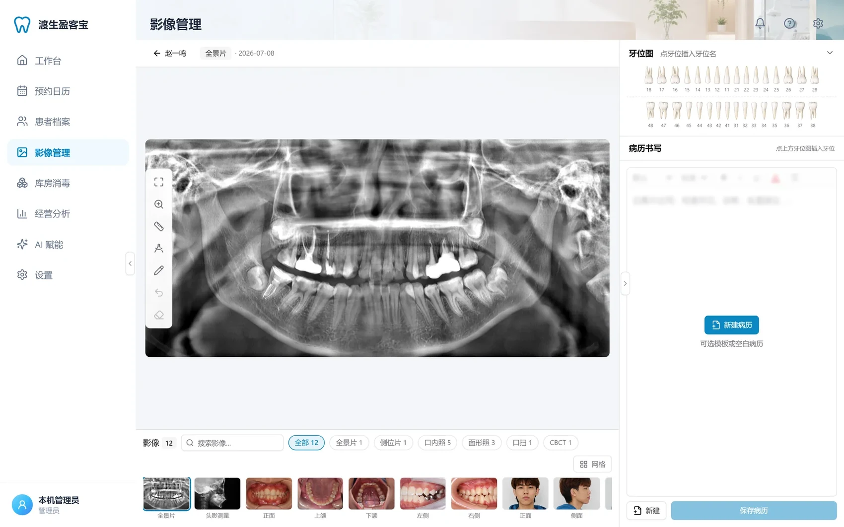 Image viewer with a panoramic X-ray
