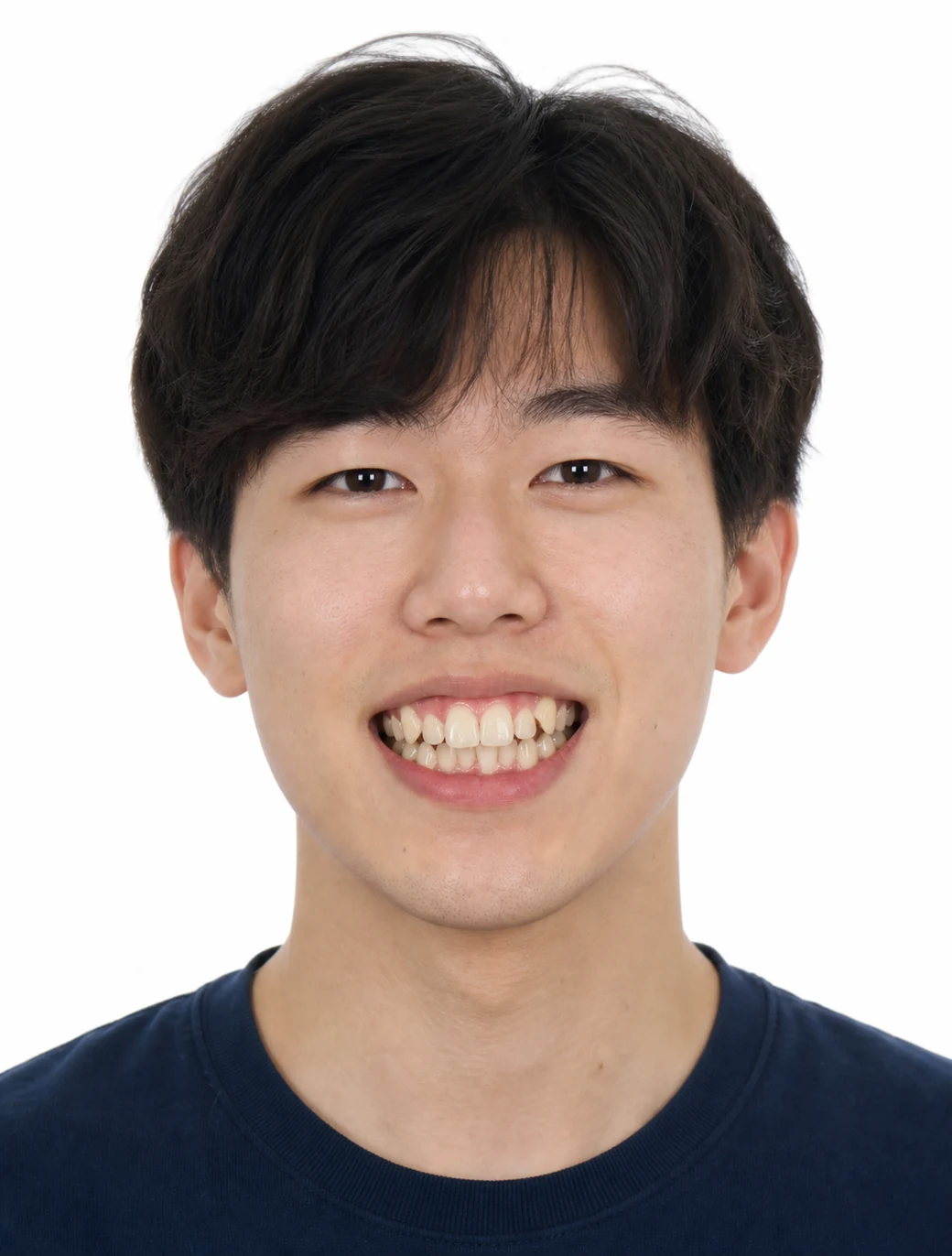 矯正前笑容