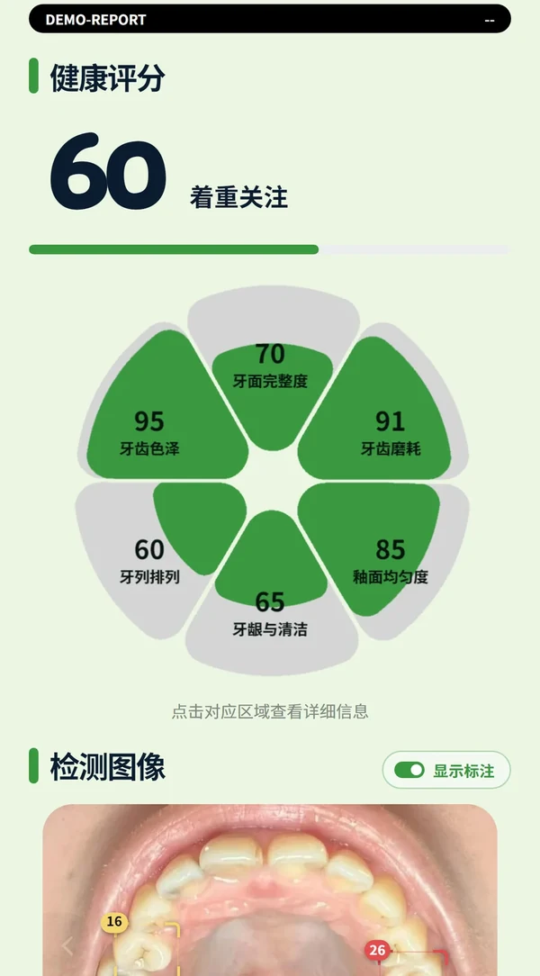 报告：健康评分与花瓣图
