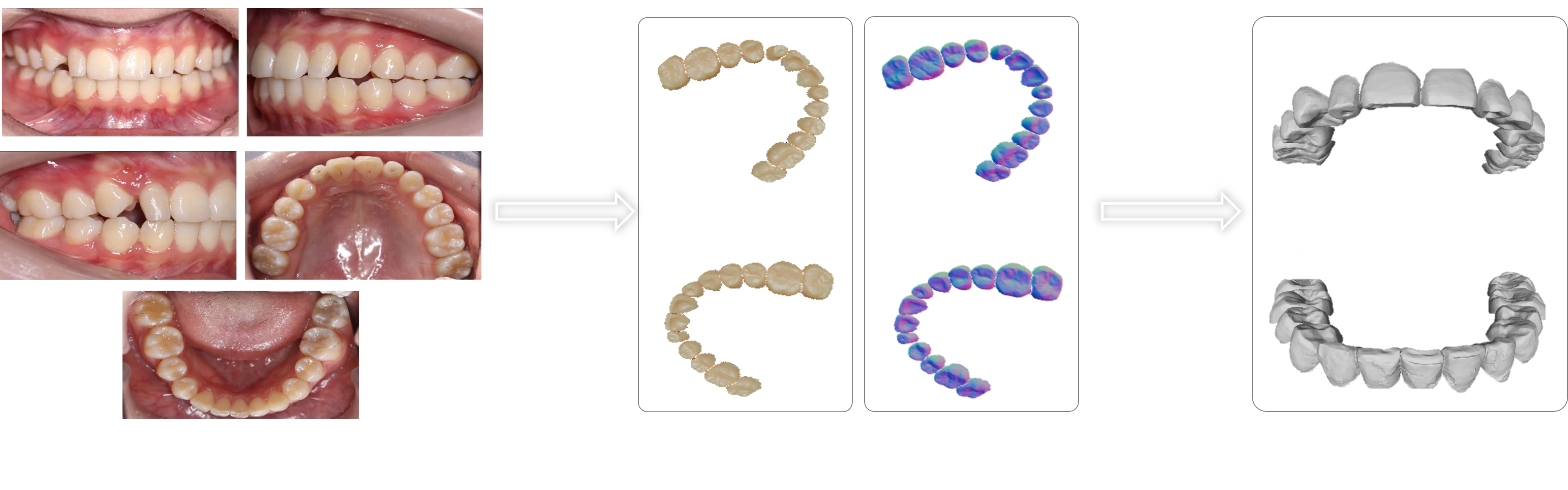 口内照片生成三维口扫模型示意图