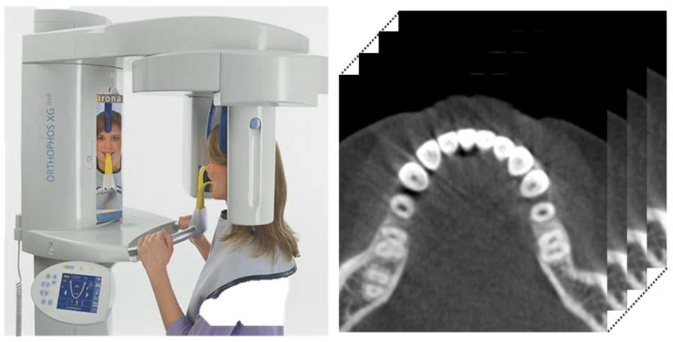CBCT 设备与扫描图