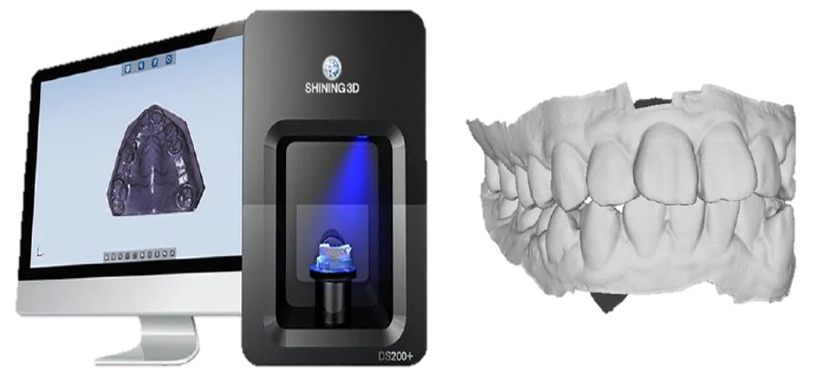 口扫设备与数据图