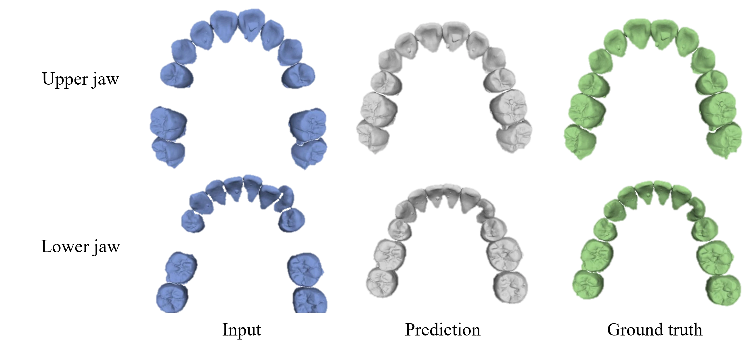 正畸方案自动设计效果图