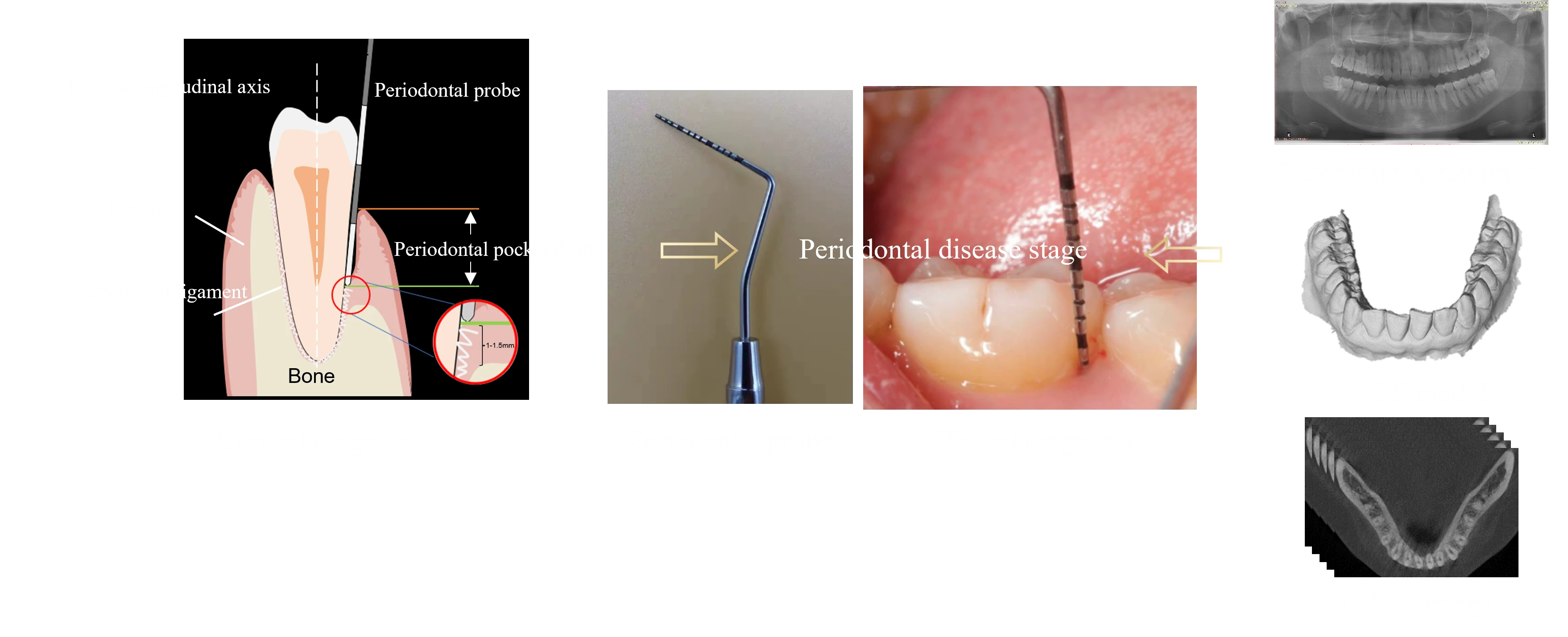 牙周病智能诊断效果图