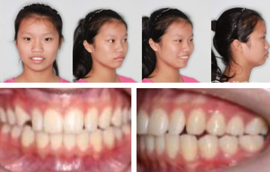 口内与面部 RGB 照片