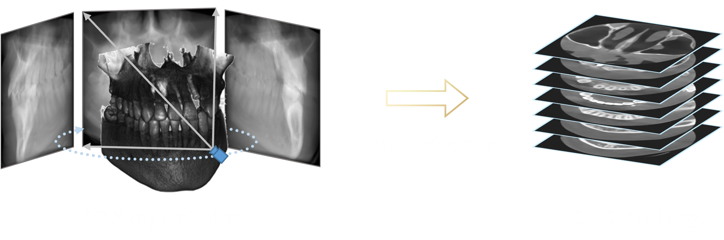 稀疏视角CBCT三维重建效果对比图