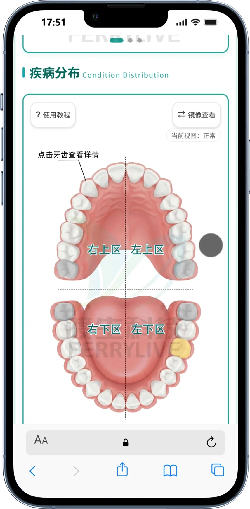 ToothHelper 检测报告示意图二